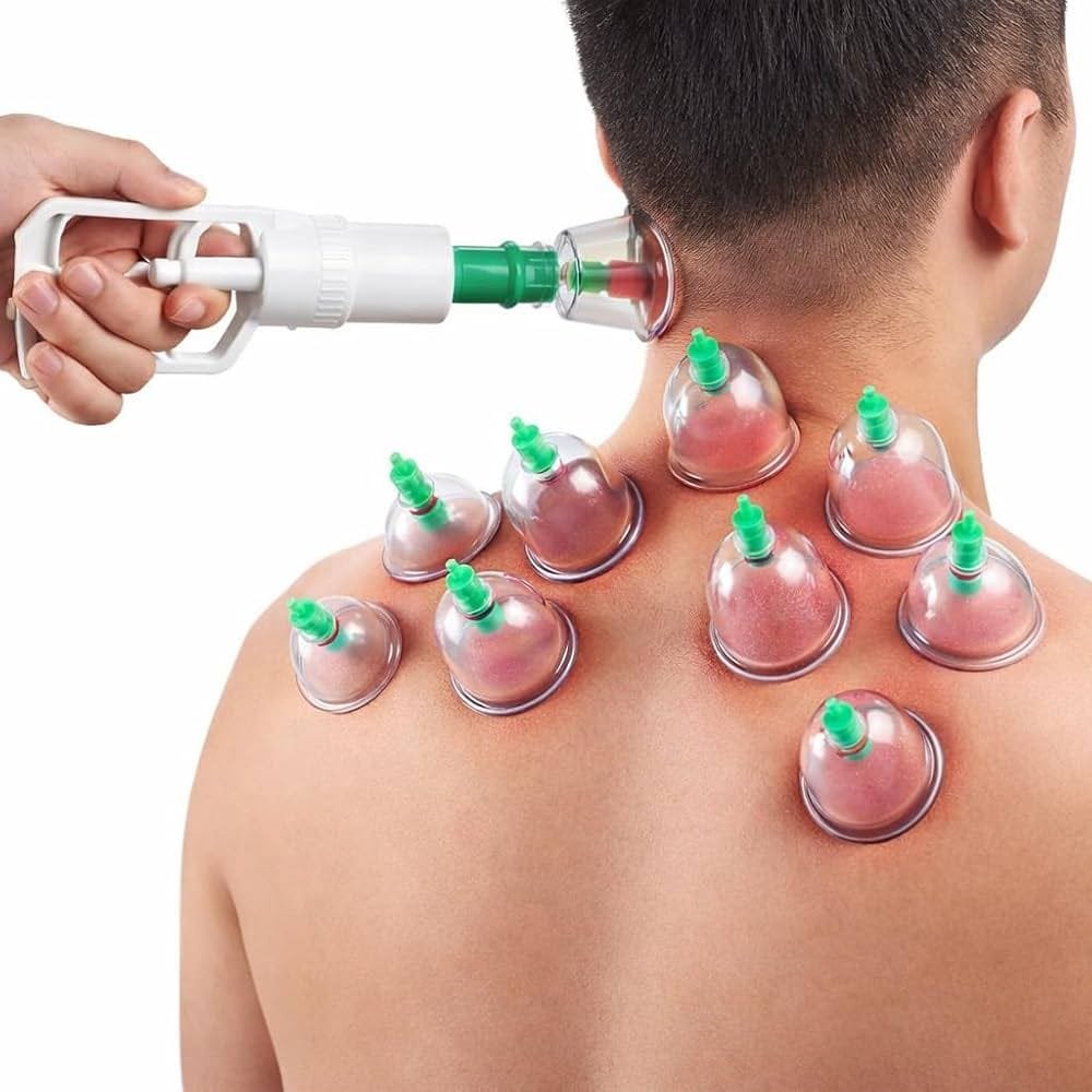Dry Cupping Therapy